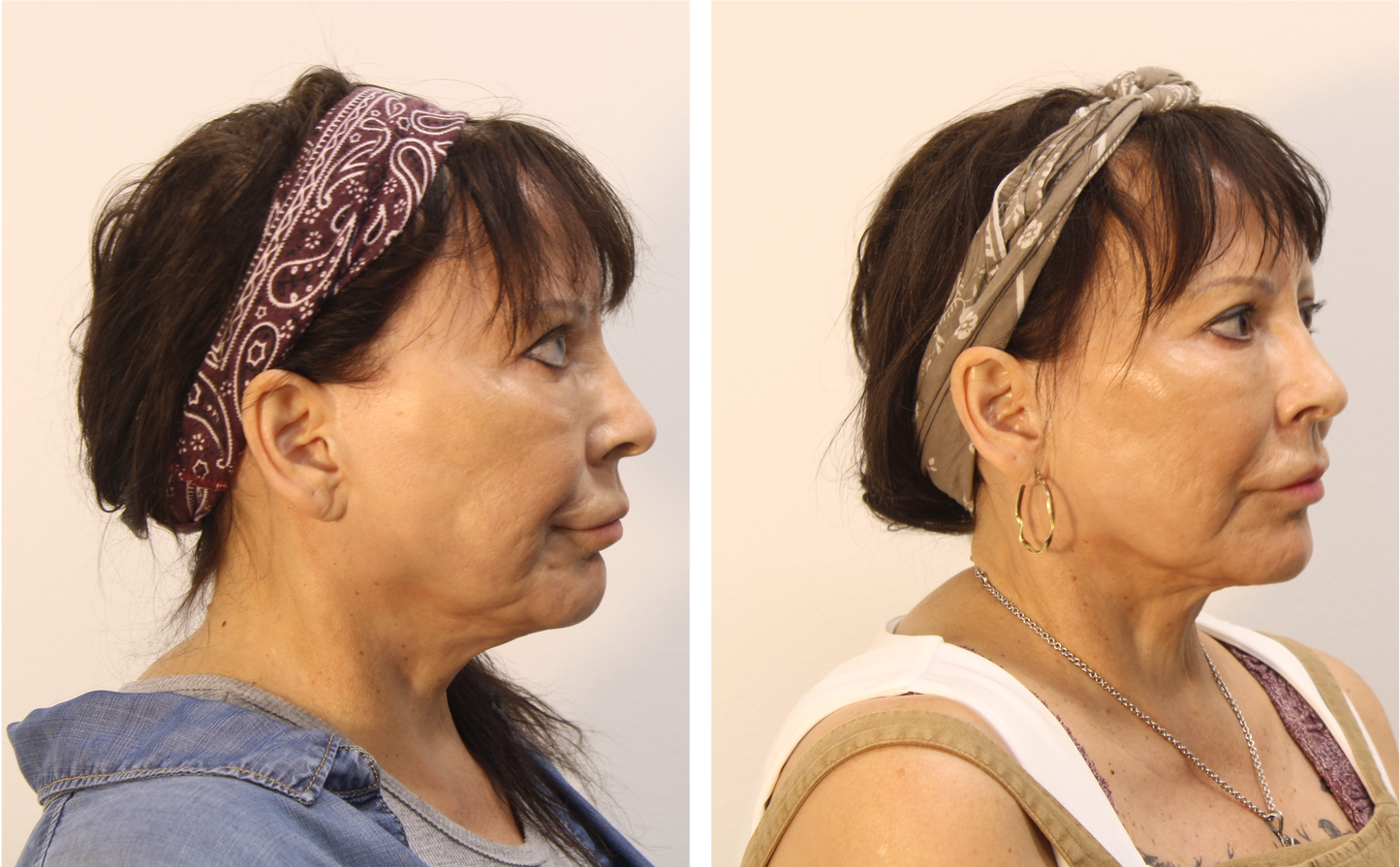 InovaSkin Starter Kit